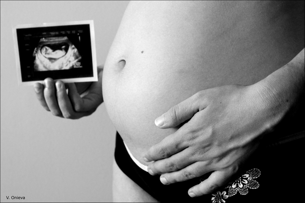 Cuidados Durante El Embarazo Ginemed Guadalajara Clínica De La Mujer Zapopan Ginemed 9784