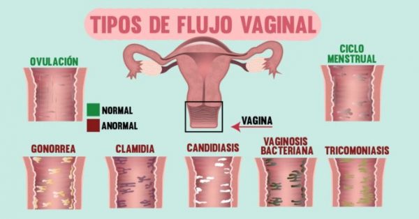 ¿por Qué Se Produce El Flujo Vaginal Ginecólogos En Guadalajara Periodo Menstrual Cicloemk 3330