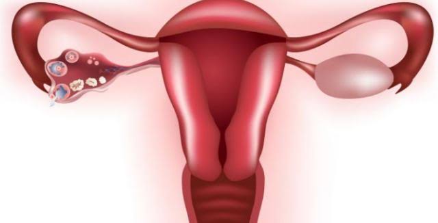Quistes En Los Ovarios Ginemed Guadalajara Clínica De La Mujer Zapopan Ginemed Ginecologos 2078